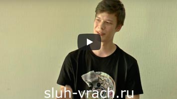 Двухсторонняя нейросенсорная тугоухость 2-й и 3-й степени. Носил два слуховых аппарата.
