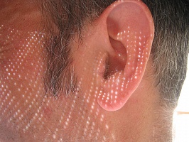 Массаж ушных раковин при нейросенсорной тугоухости.