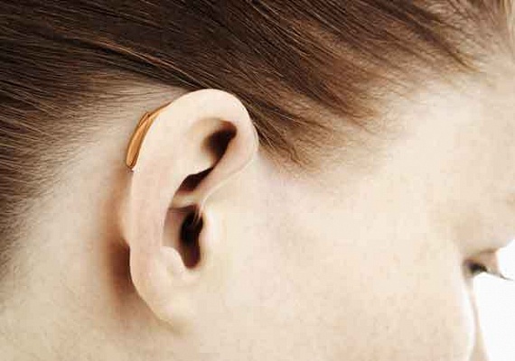 Слуховой аппарат снижает слух при нейросенсорной тугоухости 1-2 степени!!! (Часть1).