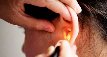 Сенсоневральная тугоухость 3 и 4 степени. Лечение в центре восстановления слуха.